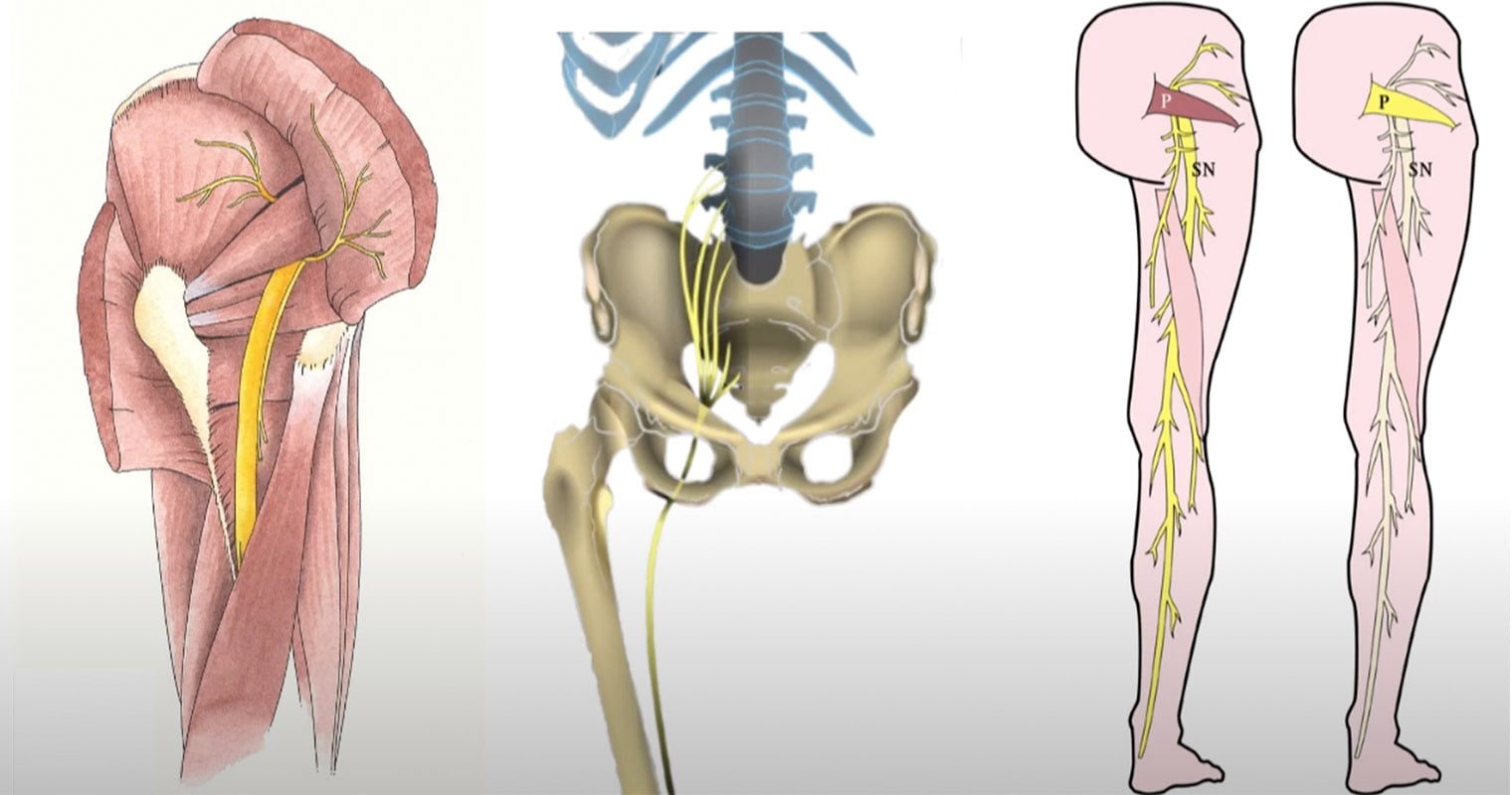 Anatomical animation showing sciatic nerve path